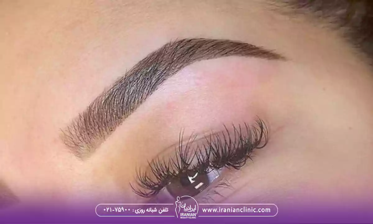ماندگاری میکرو کاشت ابرو چقدر است؟