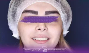کاشت ابرو دخترانه طبیعی و مدل کاشت ابرو دخترانه نچرال