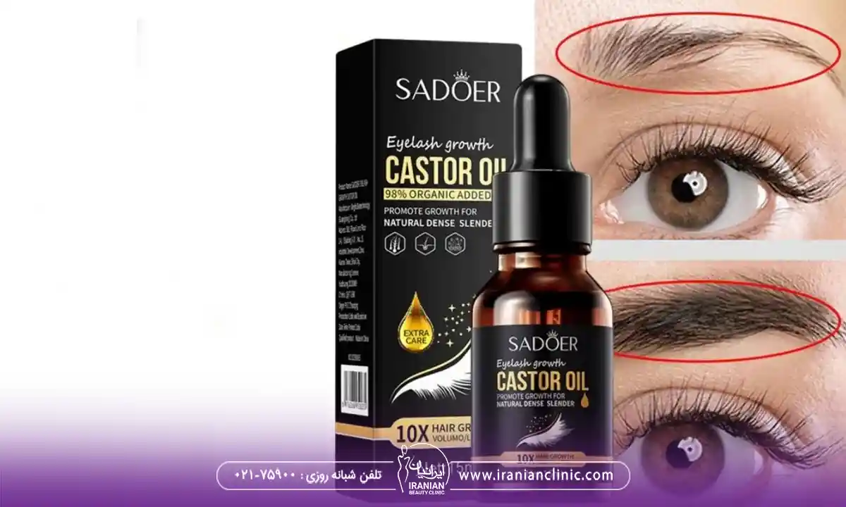 انواع روغن کرچک برای ابرو
