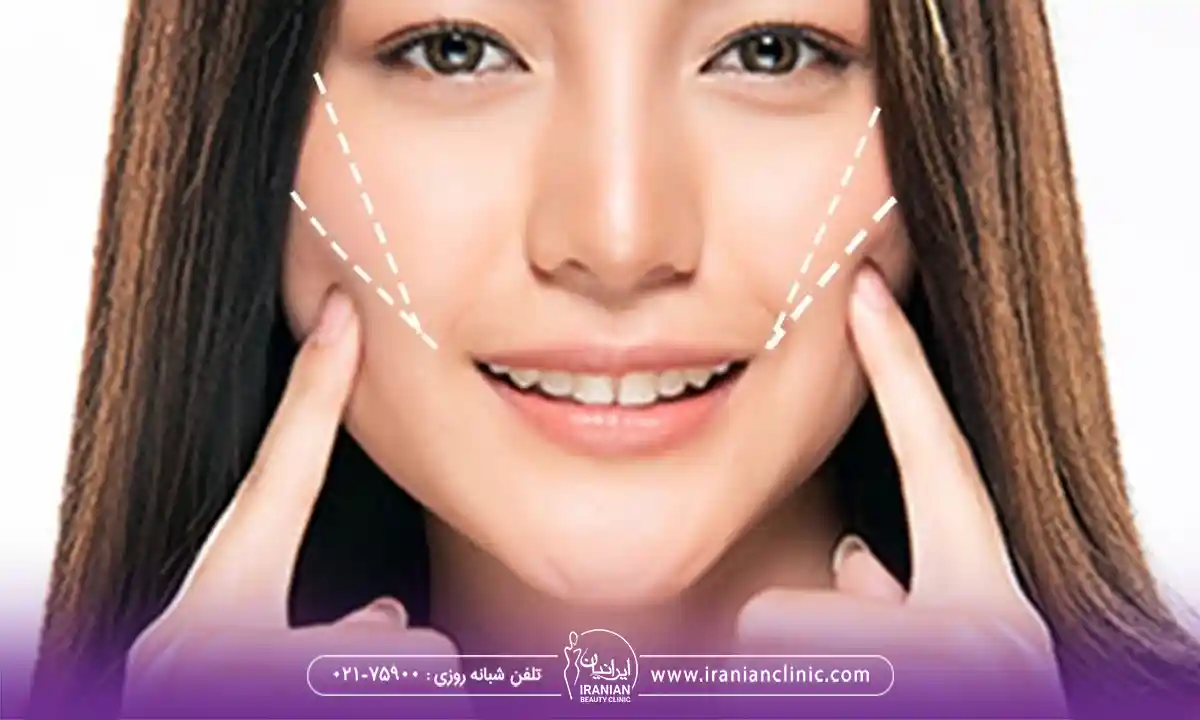 تفاوت کات گونه و سیب گونه در چیست؟
