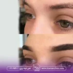مرکز برای کاشت ابرو طبیعی