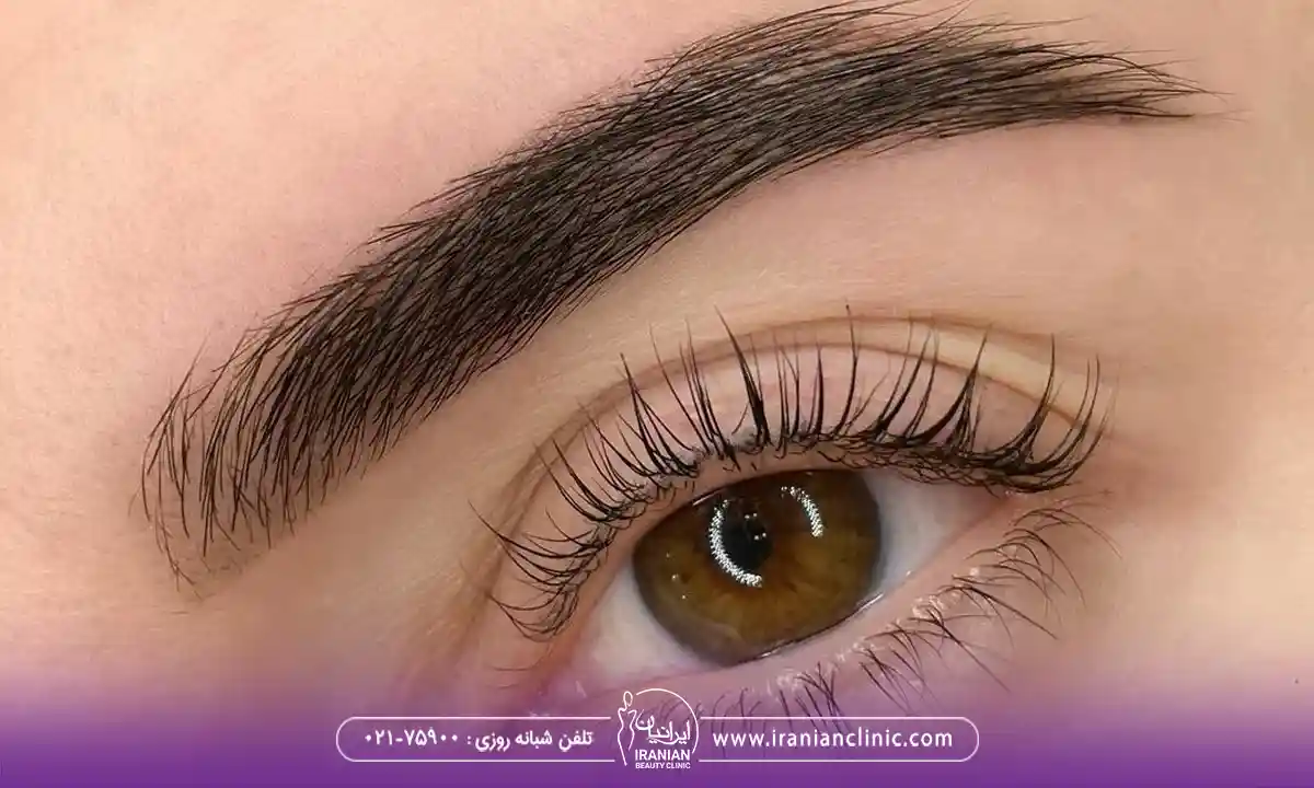 نحوه رزرو نوبت بهترین مرکز برای کاشت ابرو طبیعی