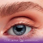 هزینه کاشت ابرو طبیعی و قیمت کاشت ابرو طبیعی