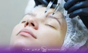 کاشت ابرو با موی دیگران چگونه انجام می شود