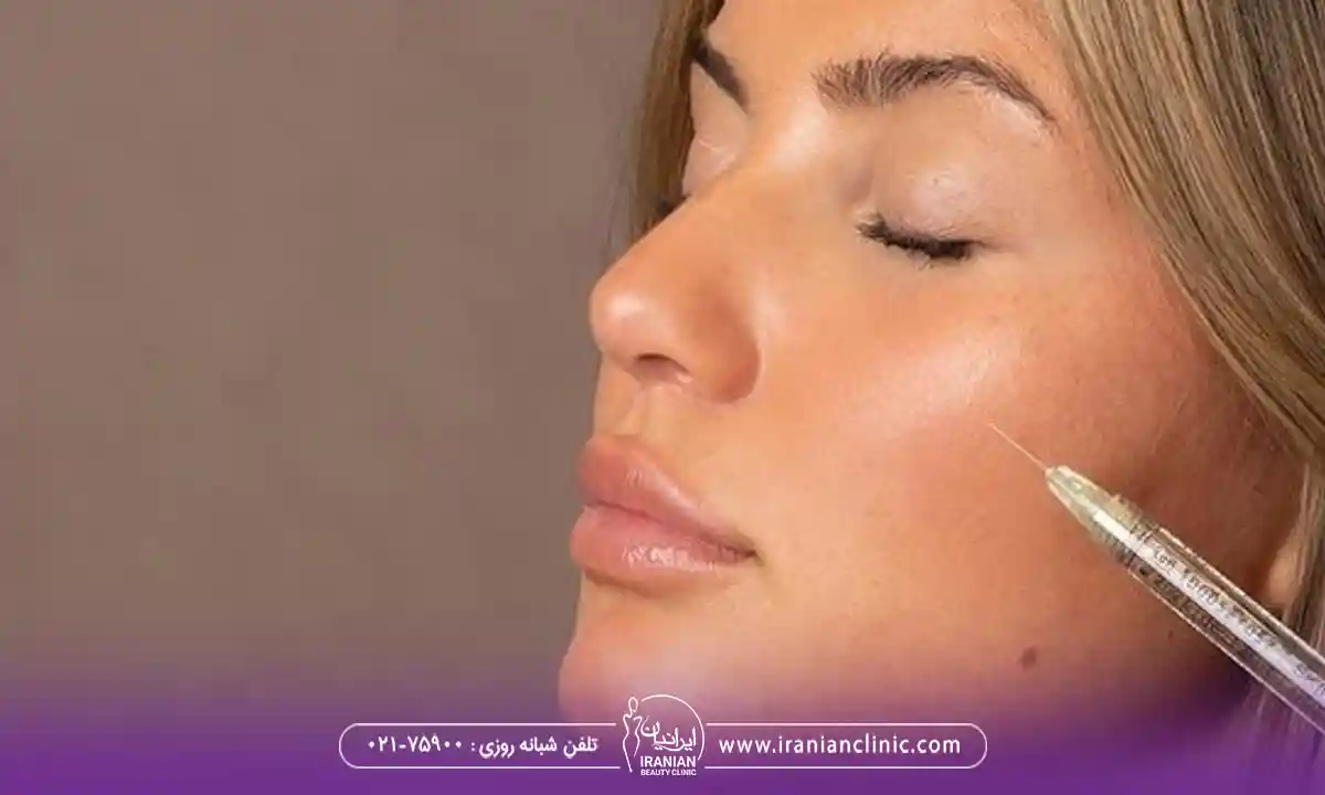 کاربردهای کات گونه با تزریق فیلر