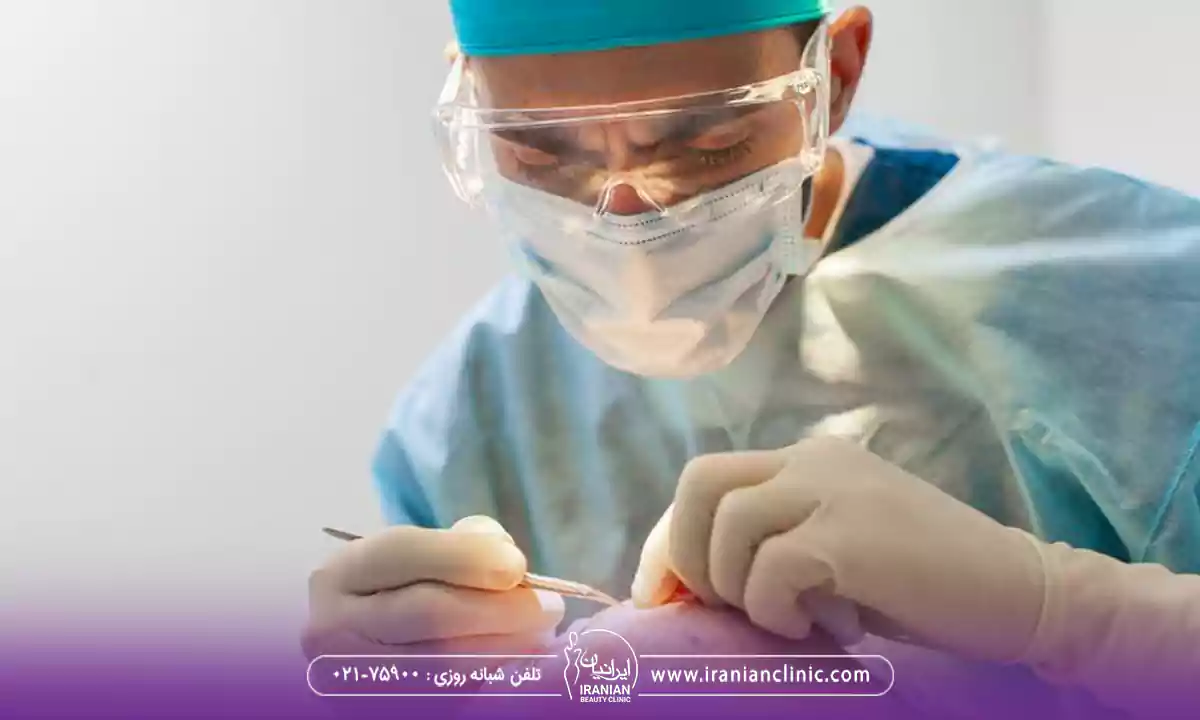 نتایج کاشت مو به روش بایوفایبر چه زمانی قابل مشاهده است؟