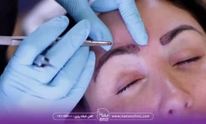 طریقه خوابیدن بعد از کاشت ابرو