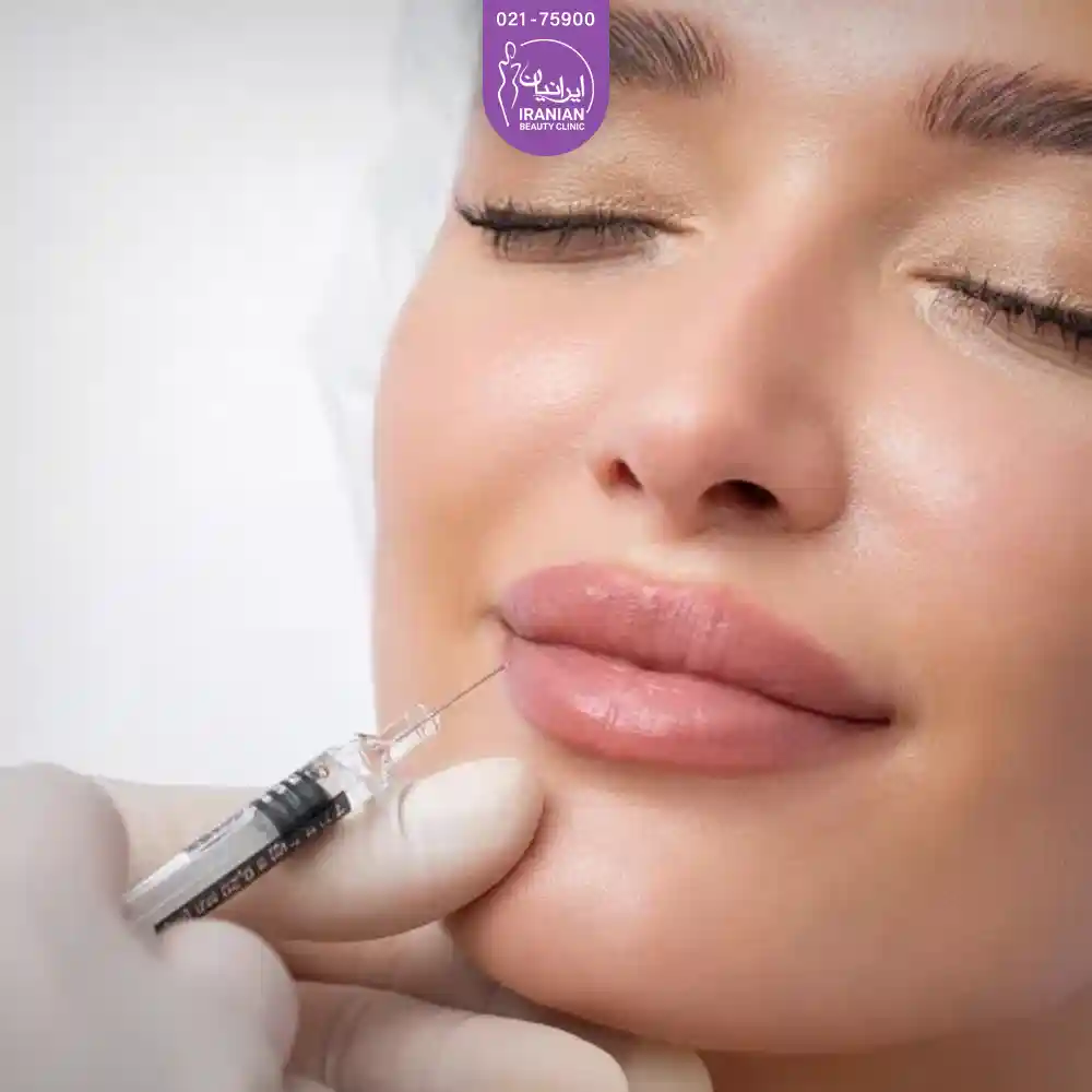 فیلر استایلج و تزریق ژل استایلج