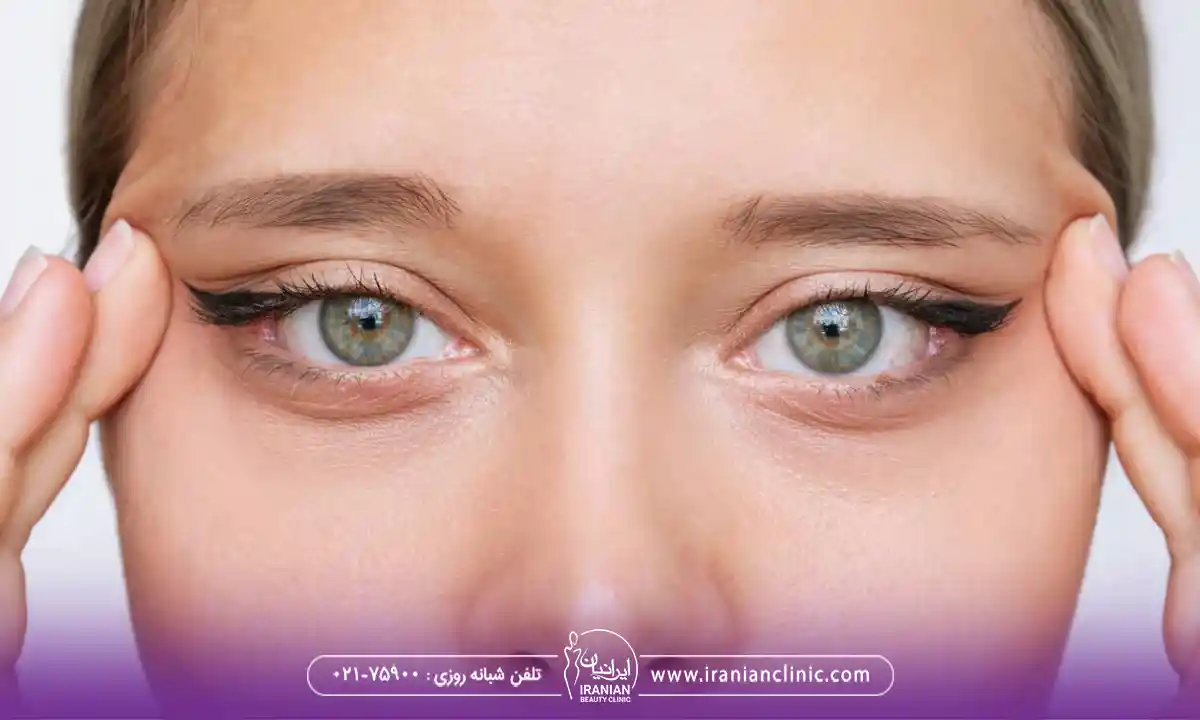 چگونه عمل کانتوپلاستی انجام میشود؟