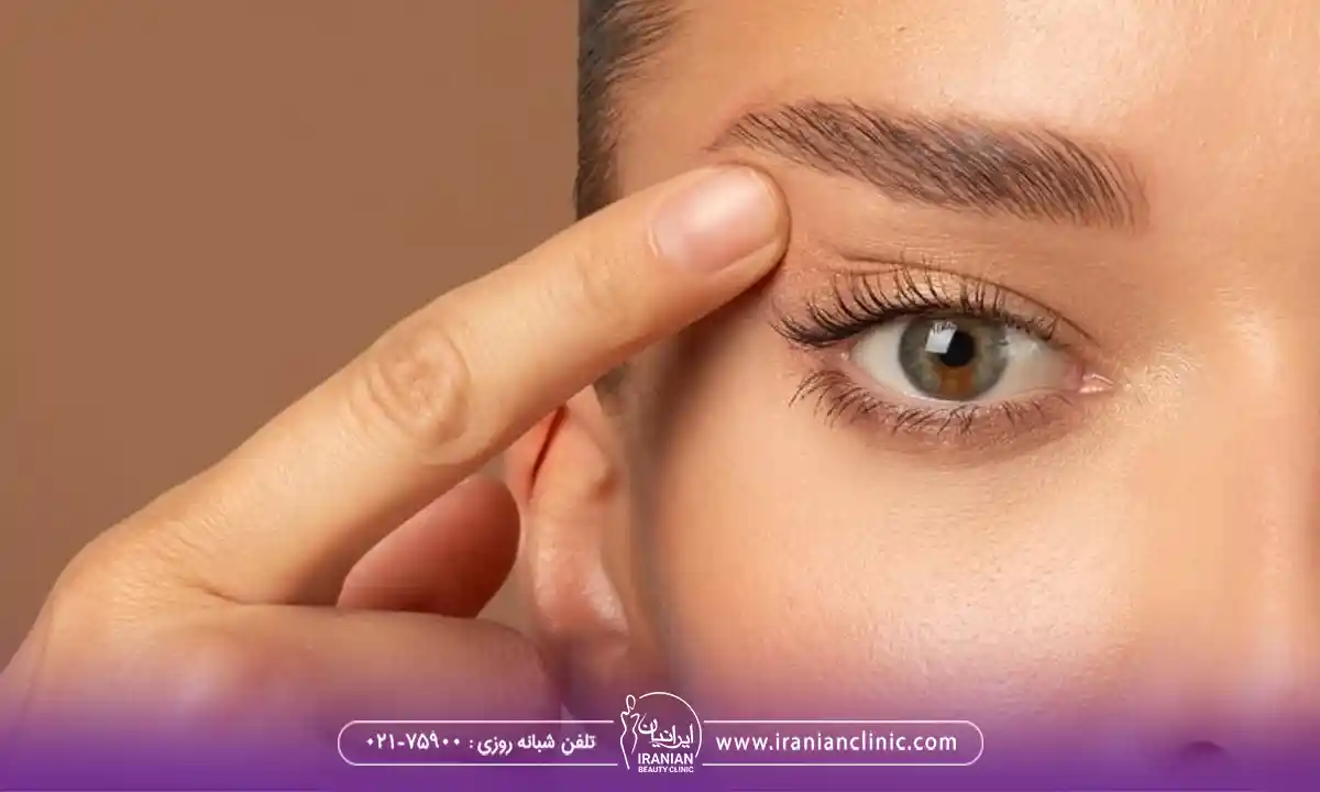 تفاوت کانتوپلاستی با لیفت شقیقه و بلفاروپلاستی