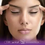 بلفاروپلاستی چشم گربه ای