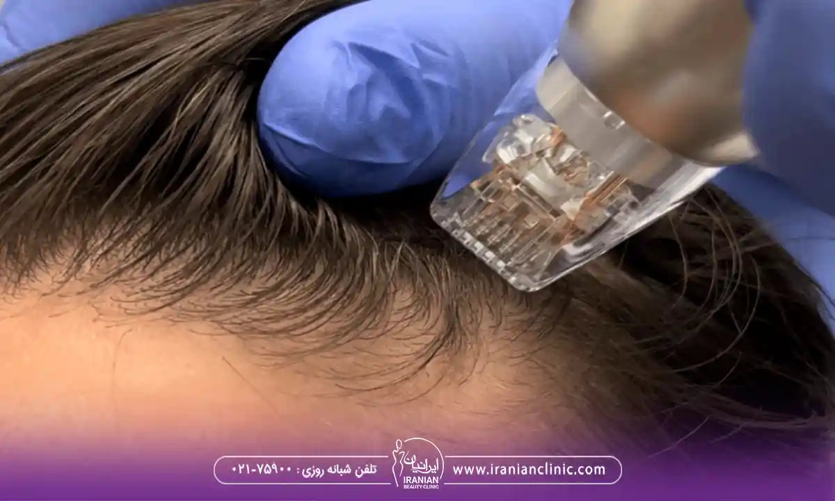 مزایای کامبینیشن تراپی چیست؟
