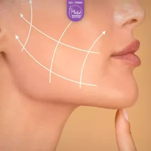 زاویه سازی صورت و بهترین انواع روش های زاویه سازی