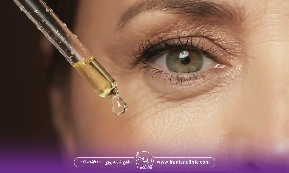 فیشیال ضدپیری یا لیفتینگ