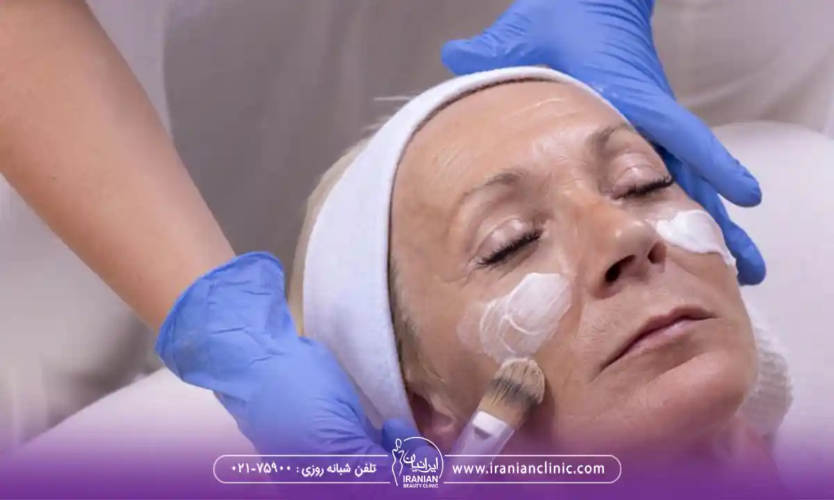 فیشیال با پلاژن تراپی