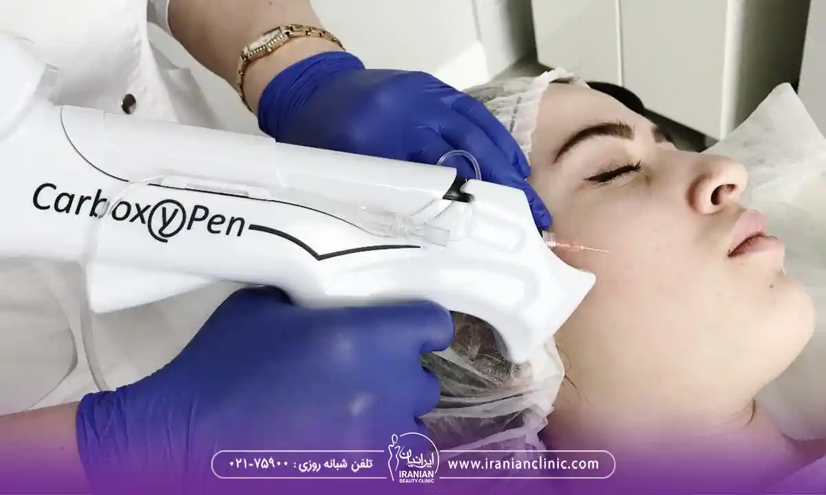 تفاوت کربوکسی تراپی در فیشیال و کربوکسی تراپی تزریقی