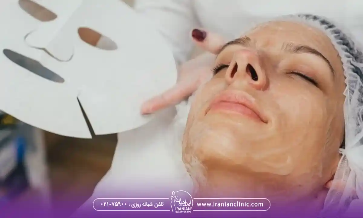 مراحل کربوکسی تراپی در فیشیال