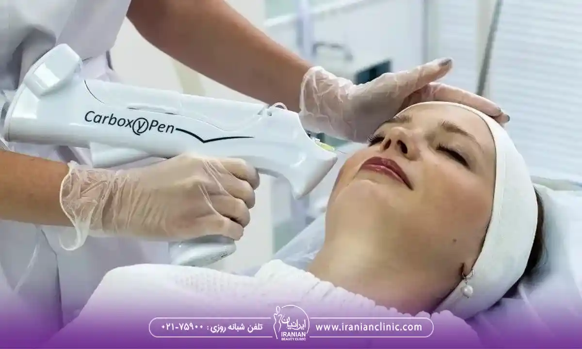 فواید کربوکسی تراپی در فیشیال