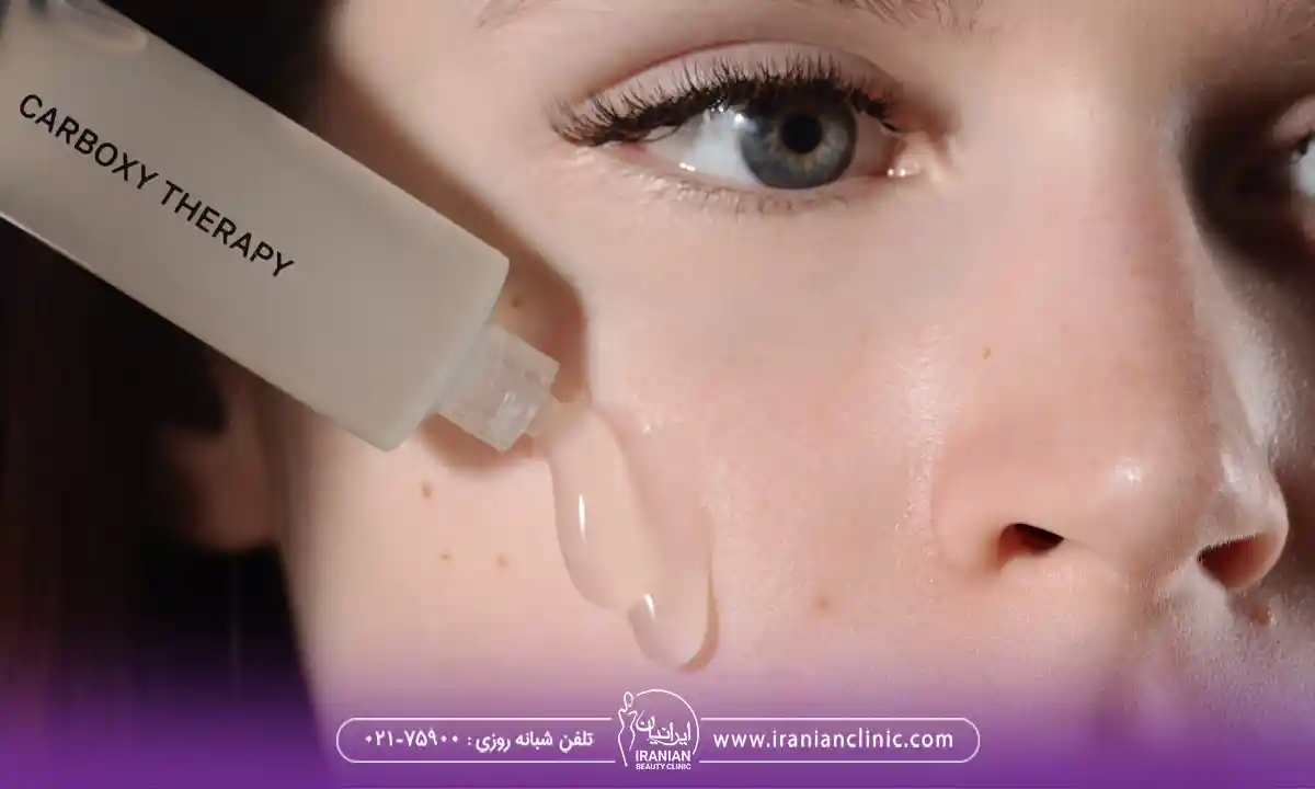 روش های کربوکسی تراپی در فیشیال