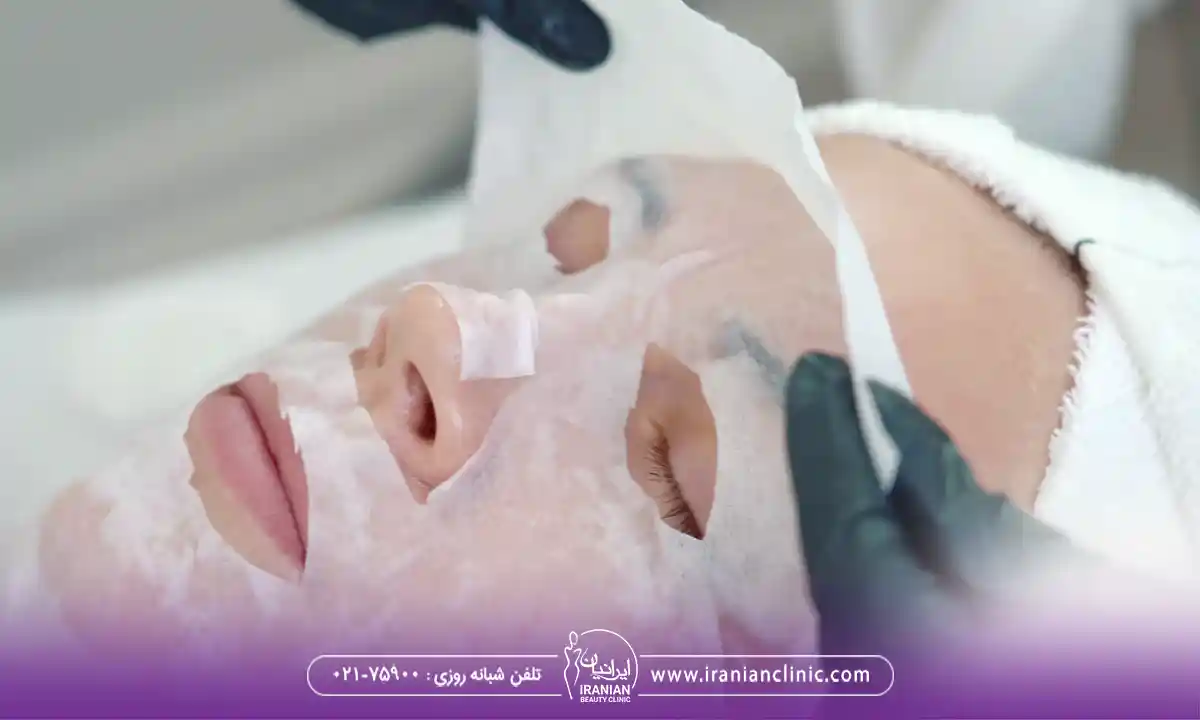 فواید کربوکسی تراپی برای فیشیال