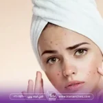 مراحل فیشیال پوست جوش دار