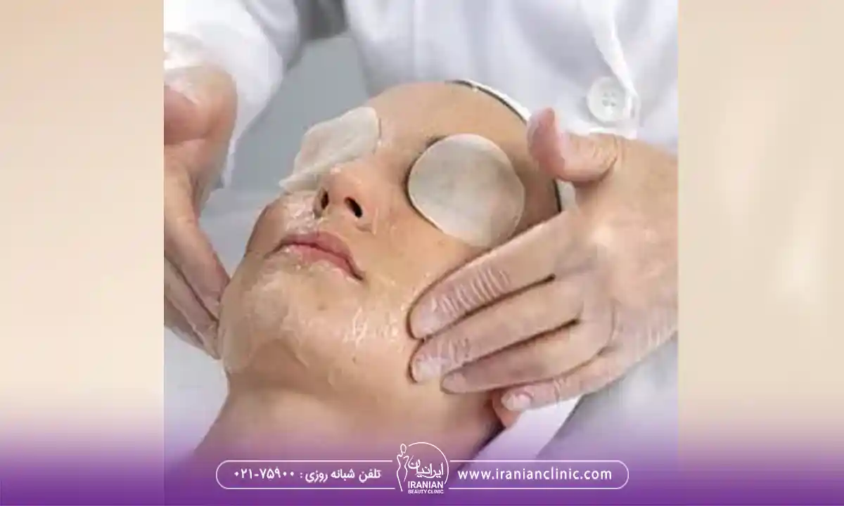 استفاده از ماسک درمانی ضدجوش در فیشیال صورت جوش دار