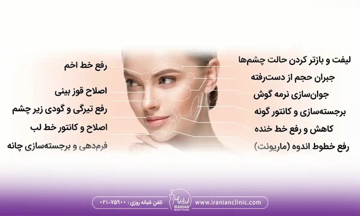 انواع فیلر برای مادلینگ صورت