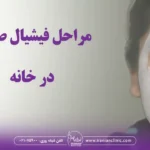 مراحل فیشیال صورت در خانه و همه چیز در مورد فیشال در خانه