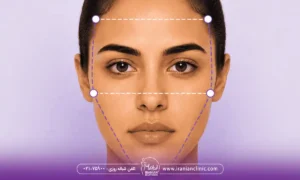 ماندگاری زاویه سازی صورت چقدر است؟ مدت ماندگاری زاویه سازی صورت با روش های مختلف
