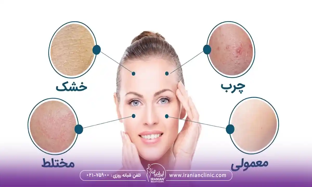 کدام نوع فیشیال، بهترین انتخاب برای ماست؟